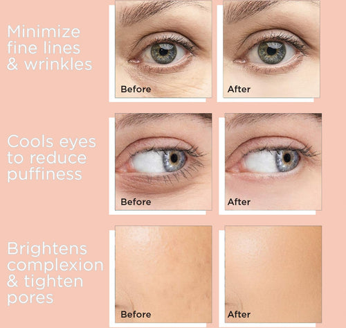 IceGlow Mini – Facial Ice Globe - MadisonGlow